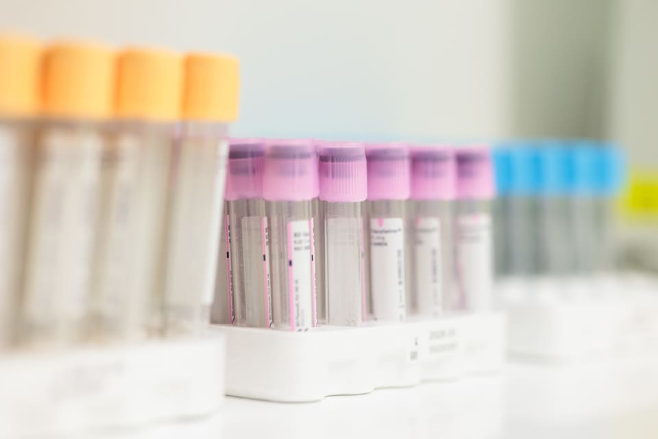 Provette mediche in laboratorio