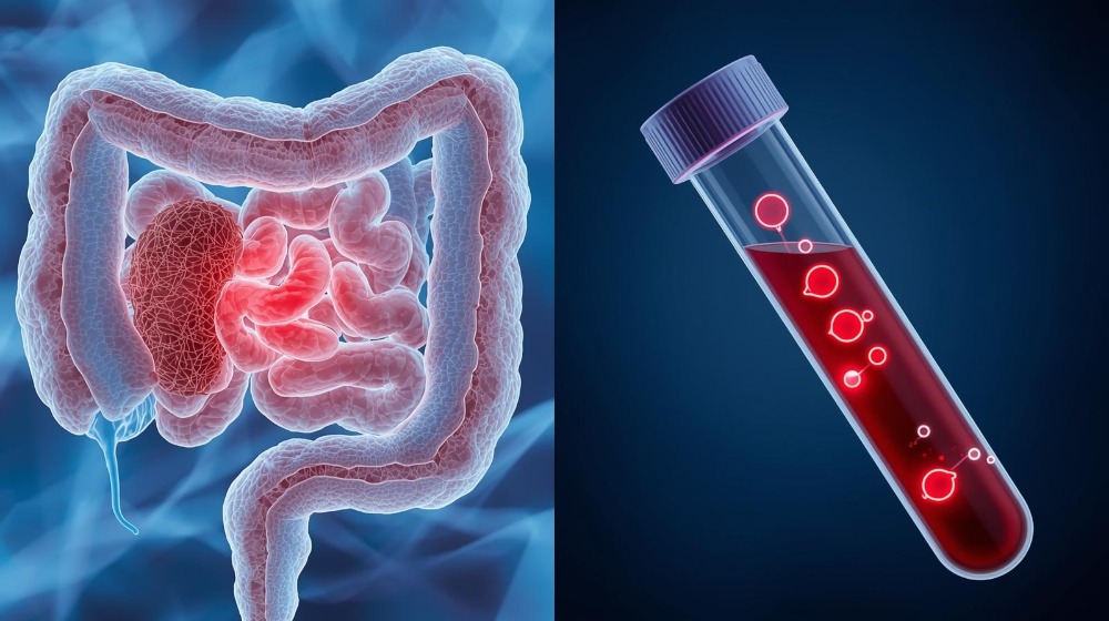Transglutaminasi reflex