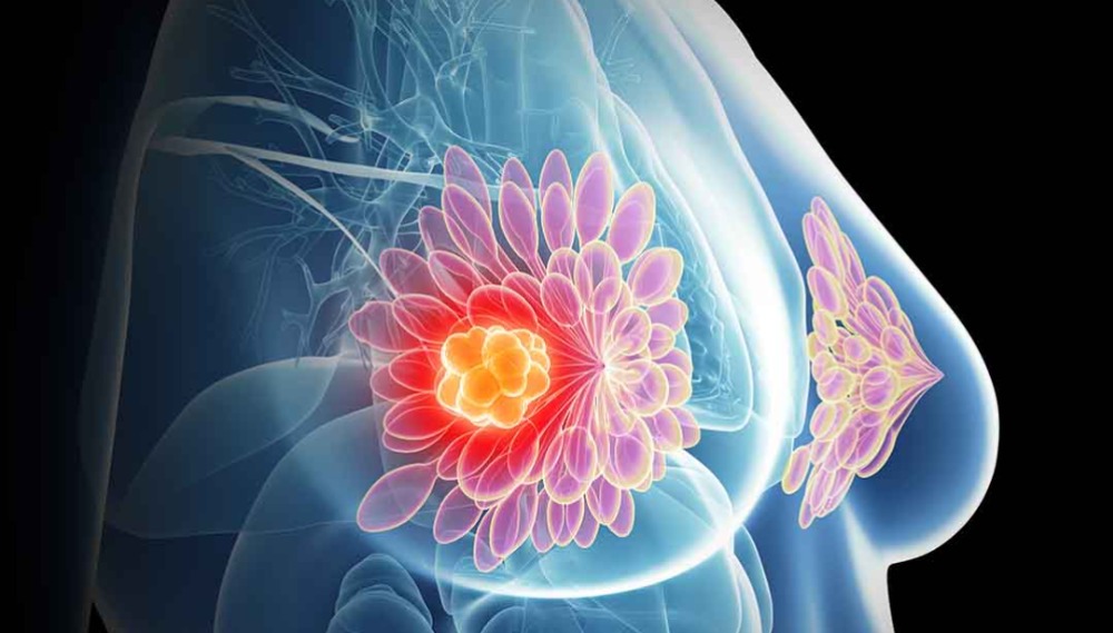 Prevenzione senologica: prendersi cura del seno a ogni età