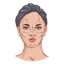 Medicina Estetica del Volto